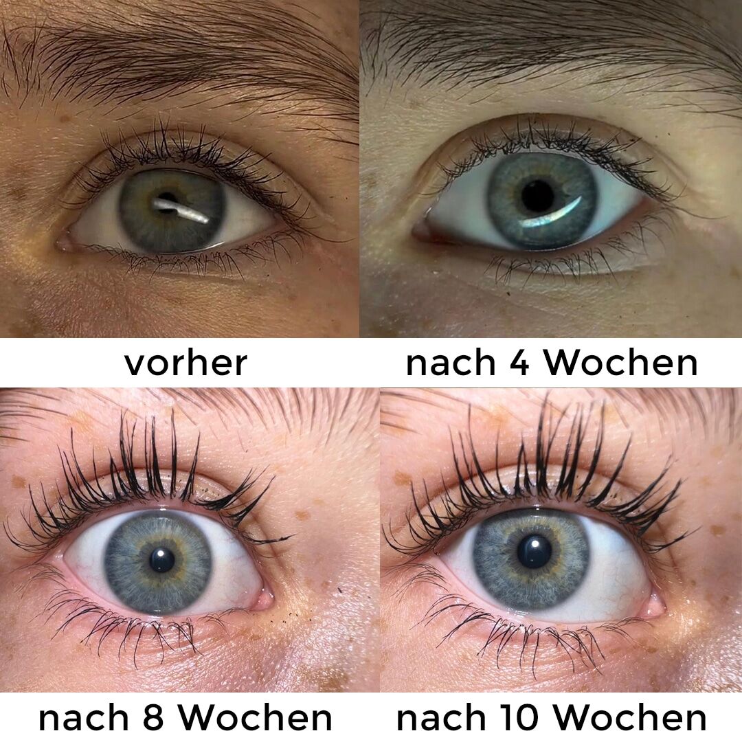 Sensitive Wimpern Booster vorher nachher Bilder